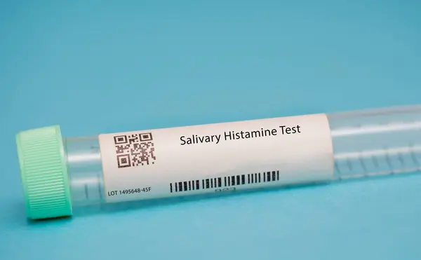 Salivary histamine test. This test measures the levels of histamine, a chemical that is involved in allergic reactions and inflammation, in the saliva.