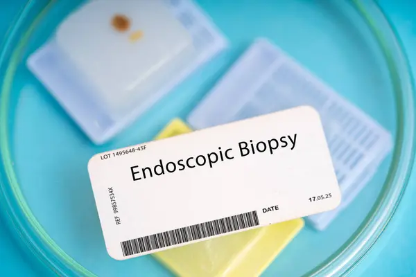 Endoscopische Biopsie Dit Type Biopsie Maakt Gebruik Van Een Endoscoop — Stockfoto