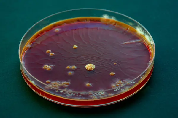 Van Dichtbij Bekijken Van Micro Organismen Petrischaaltje — Stockfoto