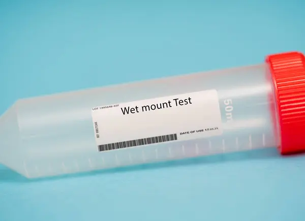 Islak Testi Islak Bağlama Testi Bakteriyel Vajinoz Mantar Enfeksiyonları Veya — Stok fotoğraf
