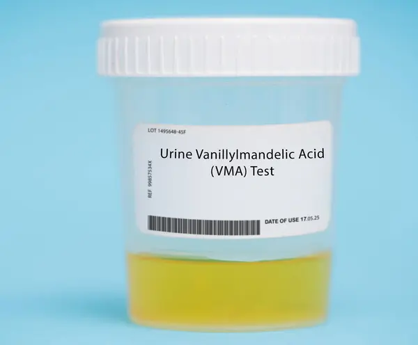 Urine Vanillylmandelic Acid Vma Test Test Measures Levels Vma Breakdown — Stock Photo, Image