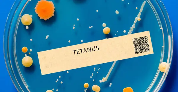 Tetanus Jest Zakażenie Bakteryjne Które Wpływa Układ Nerwowy Może Powodować — Zdjęcie stockowe
