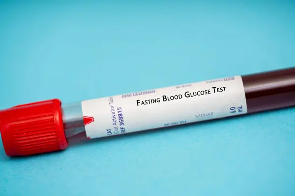Fasting Blood Glucose Test Test Measures Levels Glucose Blood Period — Stock Photo, Image
