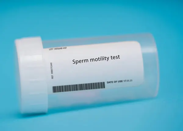 Spermiernas Motilitetstest Detta Test Utvärderar Spermiernas Förmåga Att Röra Sig — Stockfoto