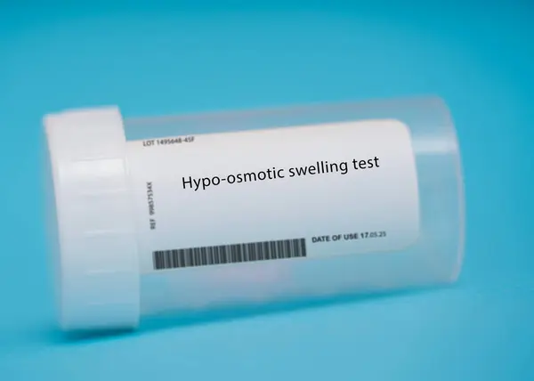 催眠性肿胀测试Hypo Osmotic Swelling Test 本试验通过使精子暴露在渗透压较低的溶液中 评估精子细胞膜的完整性 — 图库照片