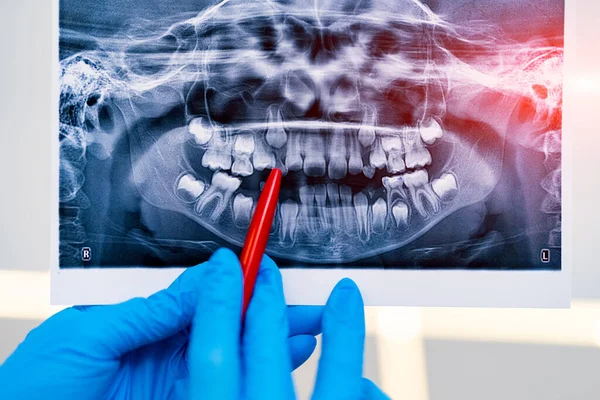 Zahnärztliche Röntgenuntersuchung Professionelle Röntgendiagnostik — Stockfoto
