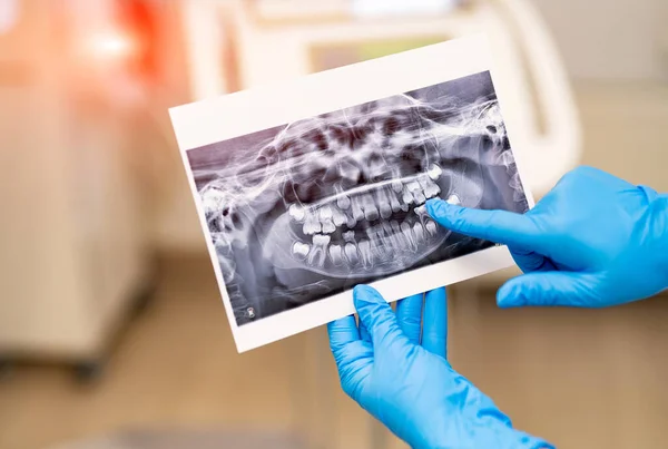 Tratamiento Ortodóncico Hospitalario Examen Dental Dental — Foto de Stock