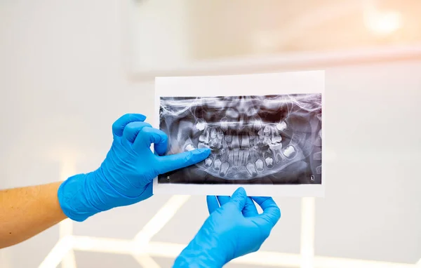 Diagnóstico Radiográfico Profesional Examen Rayos Dental — Foto de Stock