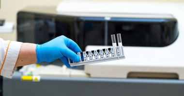 Coronavirus daignosing in hospital. Biolaboratory modern analysing.