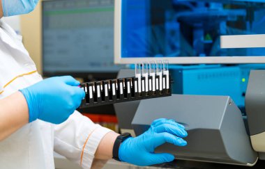 Biolaboratory modern analysing. Coronavirus daignosing in hospital.