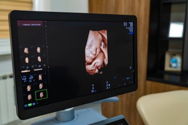 Computer pregnancy diagnostic. Healthcare sonography technologies.