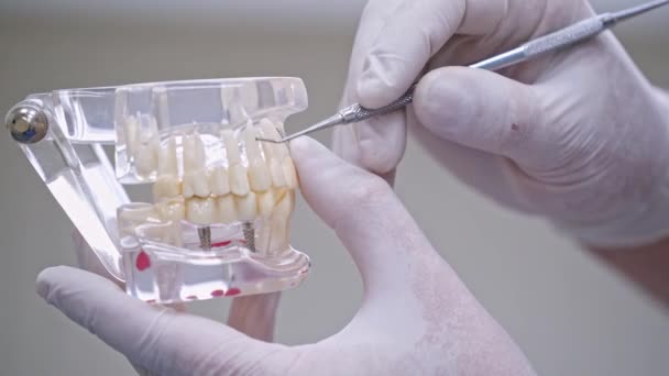 Dentista Segurando Modelo Dente Dentista Segurando Pau Apontando Para Modelo — Vídeo de Stock