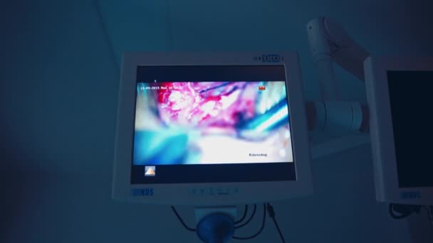 Equipo Médico Profesional Paciente Quirúrgico Que Trabaja Con Instrumentos Laparoscópicos — Vídeos de Stock