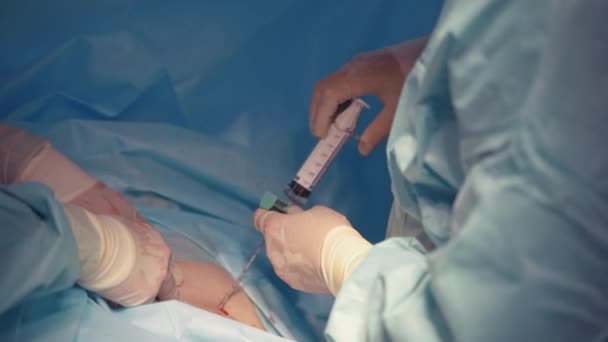 Operação Transplante Medula Óssea Cirurgiões Equipe Operação Transplante Medula Óssea — Vídeo de Stock
