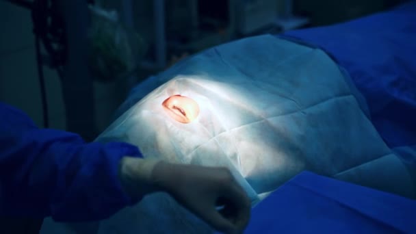Patient Unter Steriler Hülle Arzt Uniform Vor Dem Auge Operationssaal — Stockvideo