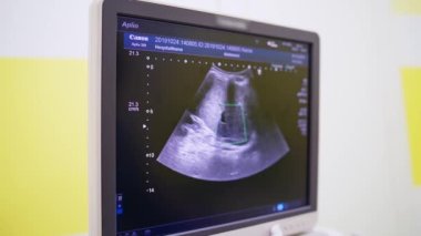 Tıbbi sonografi taraması. Modern işletim laboratuvarında ultrason makinesi
