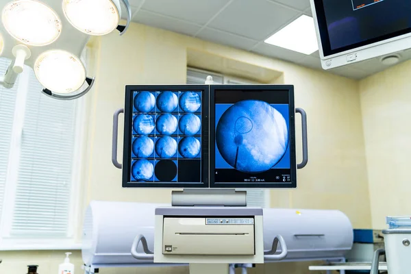 Modern medical monitoring system. New technologies professional hospital equipment.