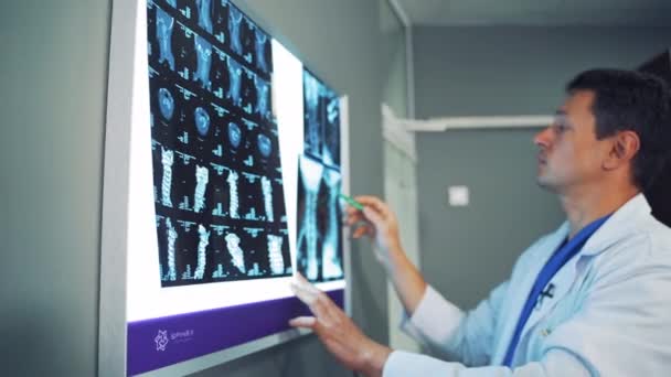 Dokter Kijkt Naar Röntgenfoto Het Ziekenhuis Ervaren Mannelijke Arts Die — Stockvideo