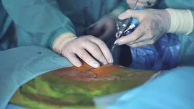 Hastanedeki ameliyathanede doktor var. Ameliyat odasındaki cerrahi hastayı kapatın.