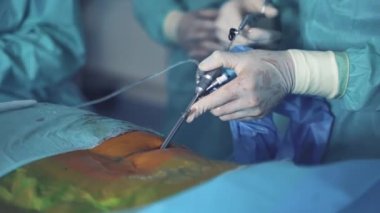 Ameliyat işlemi devam ediyor. Tıbbi ekip, parlak modern ameliyathanede cerrahi operasyon gerçekleştiriyor.