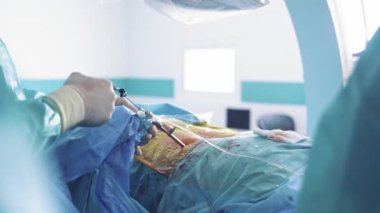 Doktorlar hastaları ameliyat eder. Bir grup konsantre cerrah hastanedeki ameliyathanede hastaları kurtarmaya çalışıyor.