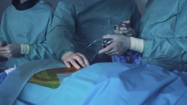 医者が手術を 患者の近くに立って手術をしながら命を救うプロの賢い外科医 — ストック動画