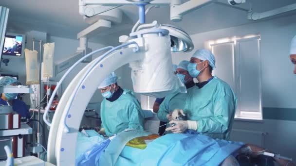 Chytrá Přesná Zdravotnická Technologie Skupina Chirurgů Operačním Sále Chirurgickým Vybavením — Stock video