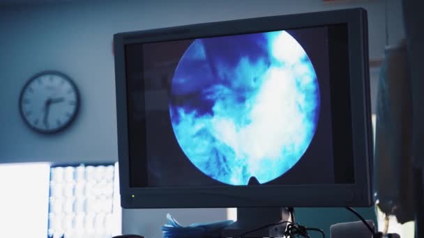 Numérisation Par Ultrasons Rayons Technologie Moderne Dans Diagnostic Des Maladies — Video