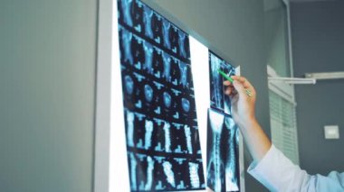 Röntgenlere bakan tıp doktorları. Ofisteki doktor röntgeni inceliyor ve tartışıyor.