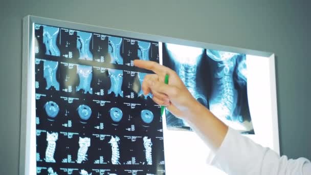 Doutor Examinando Filme Raios Visão Perto Médico Mão Analisando Radiografia — Vídeo de Stock