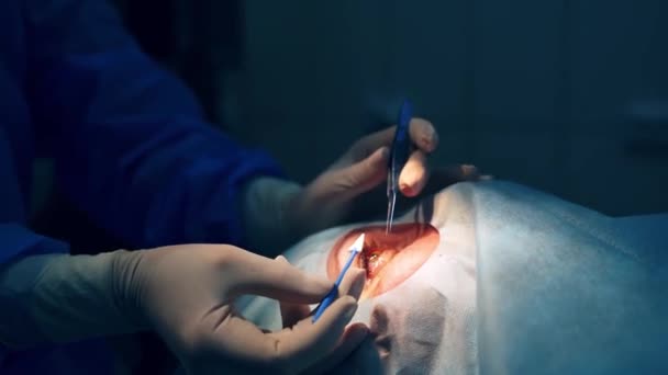 Paciente Bajo Cubierta Estéril Paciente Quirófano Durante Cirugía Oftálmica — Vídeos de Stock