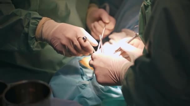 手術室の外科医のグループ 手術中に患者に集中する医師のチーム — ストック動画
