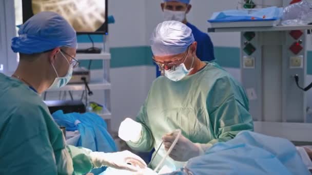 医療チームが手術を行う 手術室で患者を手術する集中外科チーム — ストック動画