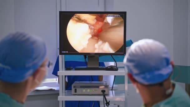 병원에서 수술실 환자를 저장하는 복강경 장비를 사용하여 마스크를 착용하는 — 비디오