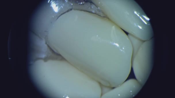 Zuby Pod Mikroskopem Pohled Mikroskopu Problémové Části Každého Zubu Detailní — Stock video