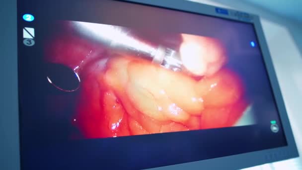 Système Chirurgical Moderne Robot Médical Chirurgie Robotique Mini Invasive — Video