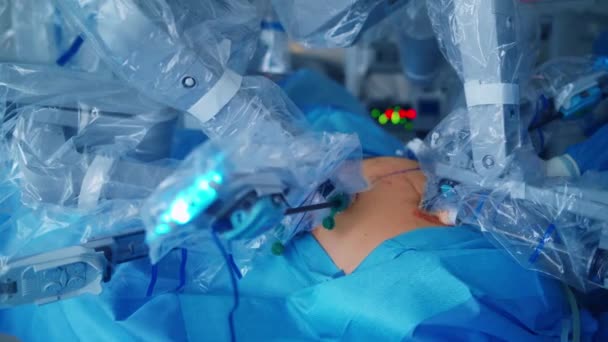 Operace Zahrnující Robot Lékařské Robota Robotické Chirurgie — Stock video