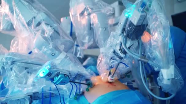 Vinci Surgical System Grupo Médicos Realizan Una Operación Paciente — Vídeos de Stock
