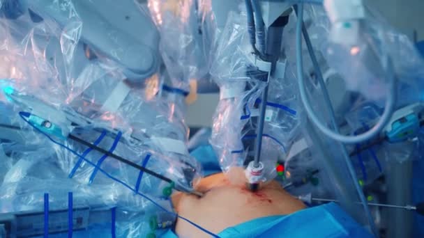 Vinci Kirurgi Medicinsk Operation Med Robot Medicinens Framtid — Stockvideo