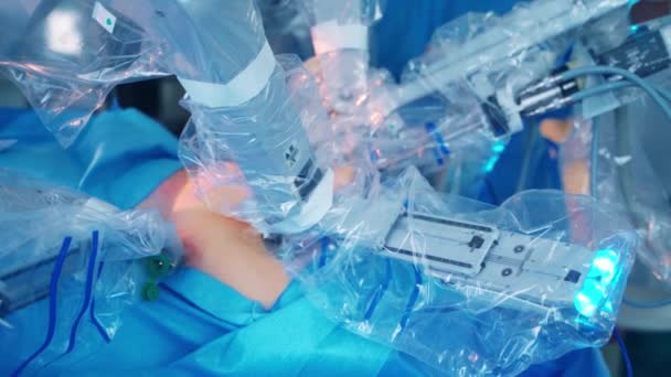 Vinci Kirurgiska Systemet Teknik Inom Kirurgi Minimalt Invasiv Robotkirurgi — Stockvideo