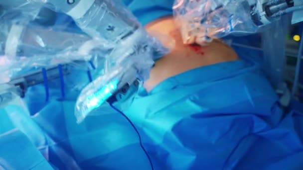 Apparecchiature Robotiche Chirurgia Operazione Complicata Con Robot Medico Moderno Che — Video Stock