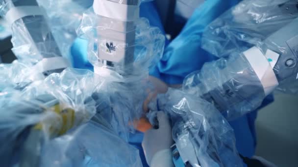 手術中の最新の医療機器 手術装置のロボットアームは クリニックで顕微鏡検査を行います クローズアップ — ストック動画
