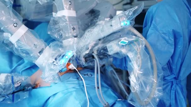 Роботизовані Озброєння Виконують Операцію Сучасне Медичне Обладнання Робить Складну Мікрохірургію — стокове відео