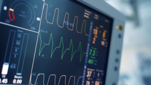 Valódi Orvosi Monitor Életjeleket Mutat Műtét Alatt Szívverés Vérnyomás Elektromos — Stock videók