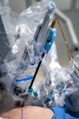 Robot sinir cerrahisi teknolojileri. Mikro cerrahi hastanesi yeniliği.