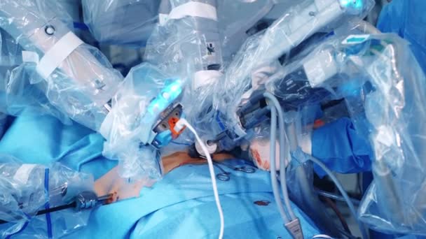 Tecnología Cirugía Robótica Para Cirujanos Máquina Quirúrgica Medicina Con Sistema — Vídeo de stock
