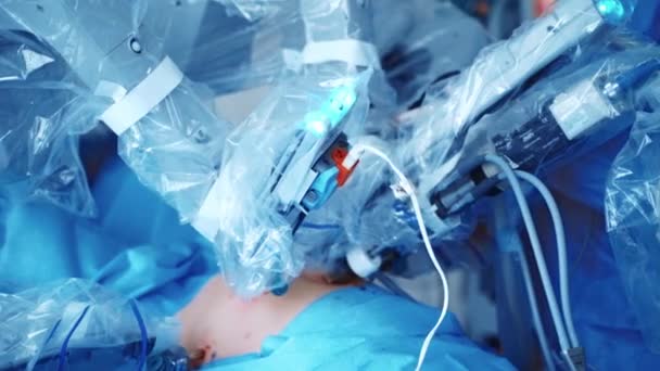 手術室 外科用ロボット 癌性腫瘍除去手術 現代医療機器について 最小侵襲ロボット手術 — ストック動画