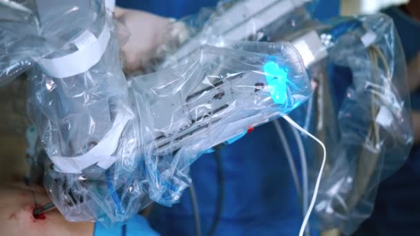 Малоінвазивна Роботизована Хірургія Операція Видалення Ракової Пухлини Сучасне Медичне Обладнання — стокове відео