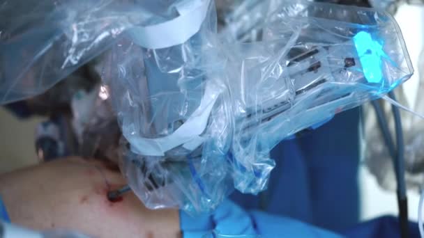 Operace Zahrnující Robot Lékařské Robota Robotické Chirurgie — Stock video