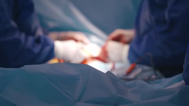 Operationsverfahren Durch Spezialisten Krankenhaus Verwischter Hintergrund Der Hände Des Chirurgen — Stockvideo